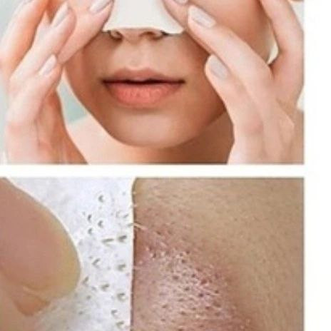 چسپ بینی ضد جوش سرسیاه