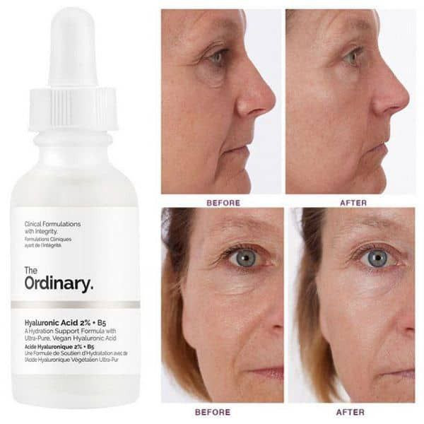 قیمت سرم آبرسان هیالورونیک اسید اوردینری Ordinary