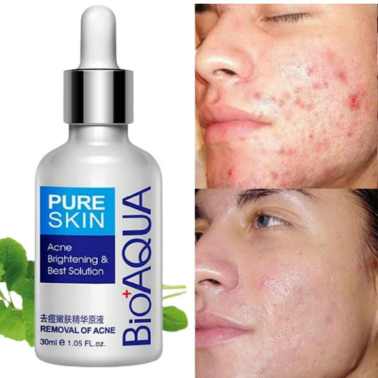 خرید آنلاین سرم ضد جوش و آکنه صورت برند بیواکوا