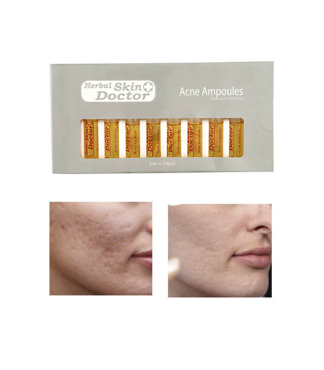 ویال دکتر اسکین ضد جوش وآکنه