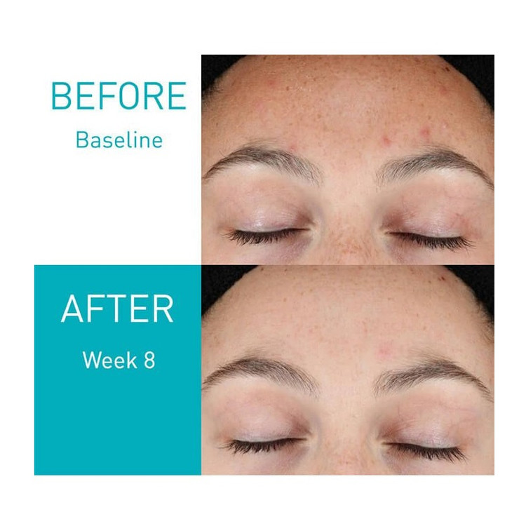 قیمت سرم رتینول سراوی