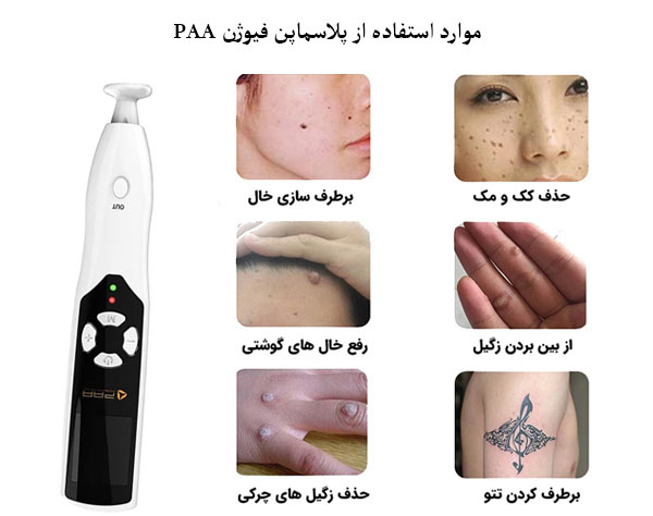 قیمت دستگاه پلاسما پن فیوژن اصلی PAA