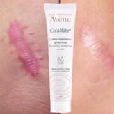 خرید آنلاین کرم ترمیم کننده قوی پوست سیکالفیت پلاس شاپ