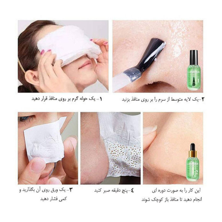 چسپ ضد جوش های سر سیاه بینی لانبنا حجم 17میلی لیتر