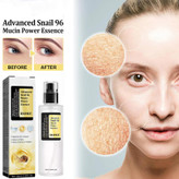 خرید سرم آبرسان صورت با فیلتر ترشح حلزون برای پوست های کدر و آسیب دیده