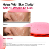 سرم نیاسینامید آنوا | ضد لک و روشن کننده